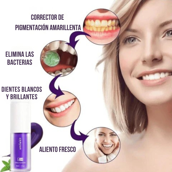Pasta Clareadora Smilekit V34 ¡Descubre tu sonrisa más blanca!